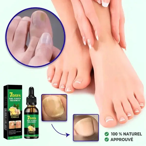Huile anti-champignons 7 Days – Formule naturelle