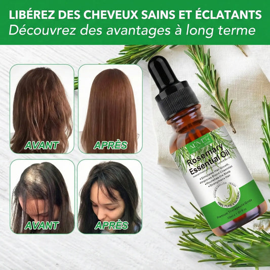 Aliver Le secret naturel pour freiner la chute et stimuler la repousse de vos cheveux.
